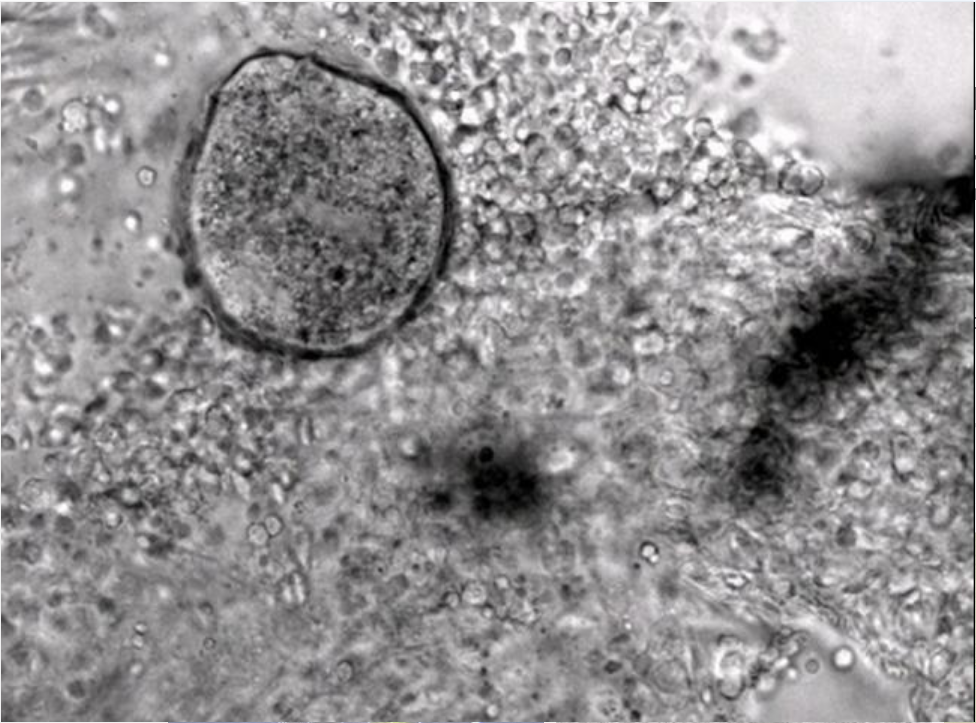 Grey microscope image